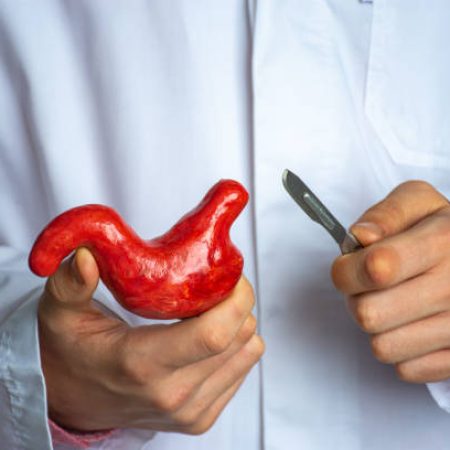 Surgeon held scalpel over anatomical model of human stomach, holding it in his hand against background of body in a white uniform. Concept photo surgical treatment of stomach ailments and procedures